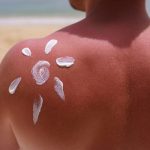 Dry skin in summer: the best ways to take care 0f it