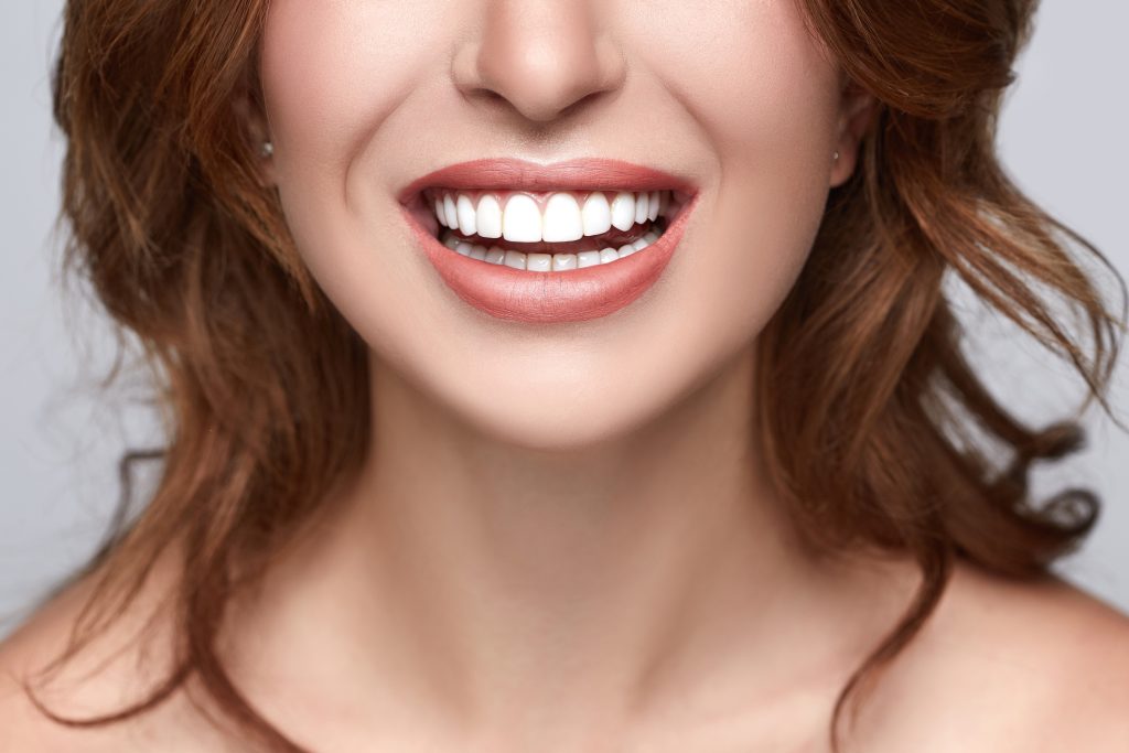 perfect whiten teeth
